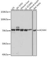 CHRNA4 Antibody in Western Blot (WB)