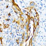 Cytokeratin 13 Antibody in Immunohistochemistry (Paraffin) (IHC (P))