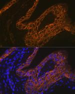 Cytokeratin 13 Antibody in Immunohistochemistry (Paraffin) (IHC (P))