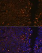 Cytokeratin 13 Antibody in Immunohistochemistry (Paraffin) (IHC (P))