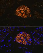 Cytokeratin 13 Antibody in Immunohistochemistry (Paraffin) (IHC (P))