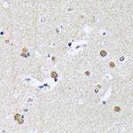 MATR3 Antibody in Immunohistochemistry (Paraffin) (IHC (P))