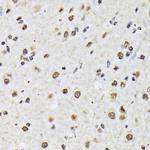 MATR3 Antibody in Immunohistochemistry (Paraffin) (IHC (P))