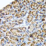 HYOU1 Antibody in Immunohistochemistry (Paraffin) (IHC (P))