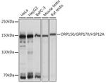 HYOU1 Antibody in Western Blot (WB)