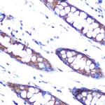 SERPINH1 Antibody in Immunohistochemistry (Paraffin) (IHC (P))