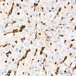 GLUT1 Antibody in Immunohistochemistry (Paraffin) (IHC (P))