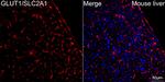 GLUT1 Antibody in Immunohistochemistry (Paraffin) (IHC (P))