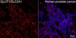 GLUT1 Antibody in Immunohistochemistry (Paraffin) (IHC (P))