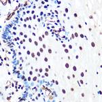 Ku80 Antibody in Immunohistochemistry (Paraffin) (IHC (P))