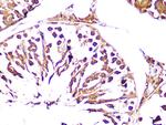 UCHL3 Antibody in Immunohistochemistry (Paraffin) (IHC (P))