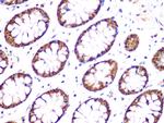 UCHL3 Antibody in Immunohistochemistry (Paraffin) (IHC (P))