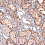 TIMM50 Antibody in Immunohistochemistry (Paraffin) (IHC (P))