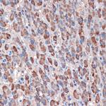 TIMM50 Antibody in Immunohistochemistry (Paraffin) (IHC (P))