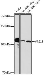 VPS18 Antibody in Western Blot (WB)