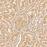 AKT1 Antibody in Immunohistochemistry (Paraffin) (IHC (P))