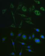 PKA alpha Antibody in Immunocytochemistry (ICC/IF)