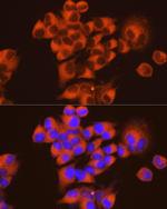 PKA alpha Antibody in Immunocytochemistry (ICC/IF)