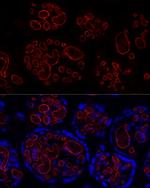 CD31 (PECAM-1) Antibody in Immunohistochemistry (Paraffin) (IHC (P))