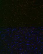 N-cadherin Antibody in Immunohistochemistry (Paraffin) (IHC (P))