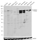 N-cadherin Antibody in Western Blot (WB)