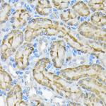 Glycerol kinase Antibody in Immunohistochemistry (Paraffin) (IHC (P))