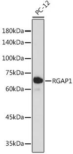 RACGAP1 Antibody in Western Blot (WB)