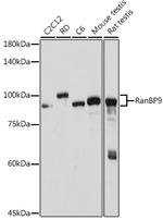 RANBP9 Antibody in Western Blot (WB)