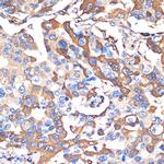 VPS28 Antibody in Immunohistochemistry (Paraffin) (IHC (P))