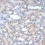 XPD Antibody in Immunohistochemistry (Paraffin) (IHC (P))