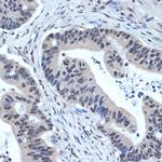 XPD Antibody in Immunohistochemistry (Paraffin) (IHC (P))