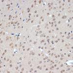 XPD Antibody in Immunohistochemistry (Paraffin) (IHC (P))