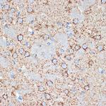 GOT2 Antibody in Immunohistochemistry (Paraffin) (IHC (P))