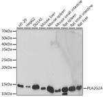 PLA2G2A Antibody in Western Blot (WB)