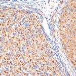 gamma Adaptin Antibody in Immunohistochemistry (Paraffin) (IHC (P))