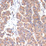 gamma Adaptin Antibody in Immunohistochemistry (Paraffin) (IHC (P))