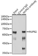 NUP62 Antibody in Immunoprecipitation (IP)