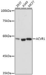 ACVR1 Antibody in Western Blot (WB)