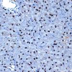 NAT10 Antibody in Immunohistochemistry (Paraffin) (IHC (P))