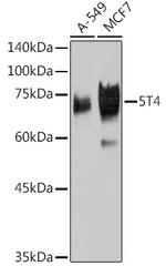 5T4 Antibody in Western Blot (WB)