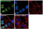 Androgen Receptor Antibody in Immunocytochemistry (ICC/IF)