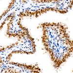 Androgen Receptor Antibody in Immunohistochemistry (Paraffin) (IHC (P))