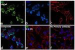 Androgen Receptor Antibody