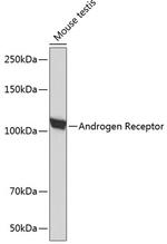 Androgen Receptor Antibody in Western Blot (WB)