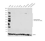 Androgen Receptor Antibody in Western Blot (WB)