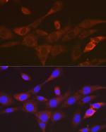 TACC3 Antibody in Immunocytochemistry (ICC/IF)