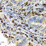 TACC3 Antibody in Immunohistochemistry (Paraffin) (IHC (P))