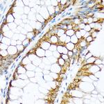 ENTPD5 Antibody in Immunohistochemistry (Paraffin) (IHC (P))