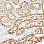 ENTPD5 Antibody in Immunohistochemistry (Paraffin) (IHC (P))