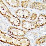 ENTPD5 Antibody in Immunohistochemistry (Paraffin) (IHC (P))